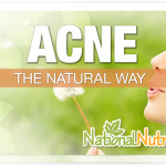 Acne - Natural Treatment Options