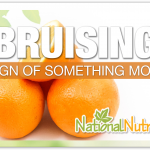 Bruising