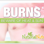Burns & Sunburn