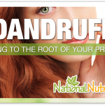 Dandruff