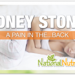 Kidney Stones