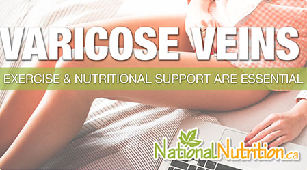 glutathione varicose veins How To Treat and Prevent Varicose Veins From NationalNutrition.ca