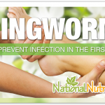 Ringworm: Symptoms & Treatments