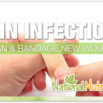 Skin Infections