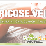 How To Prevent Varicose Veins