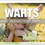 Warts